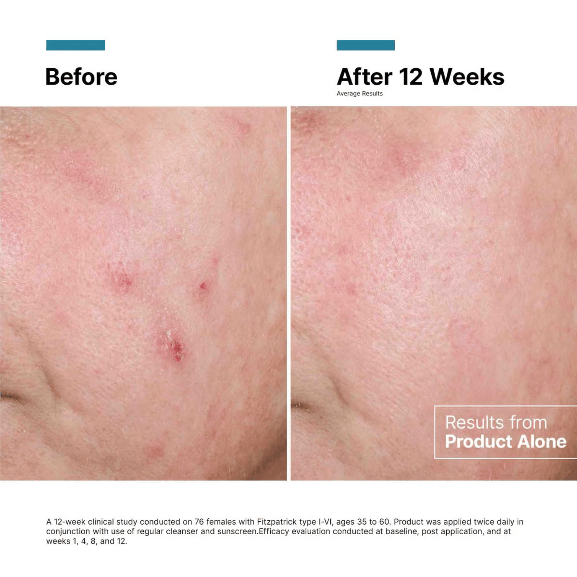 SkinCeuticals Advanced RGN-6