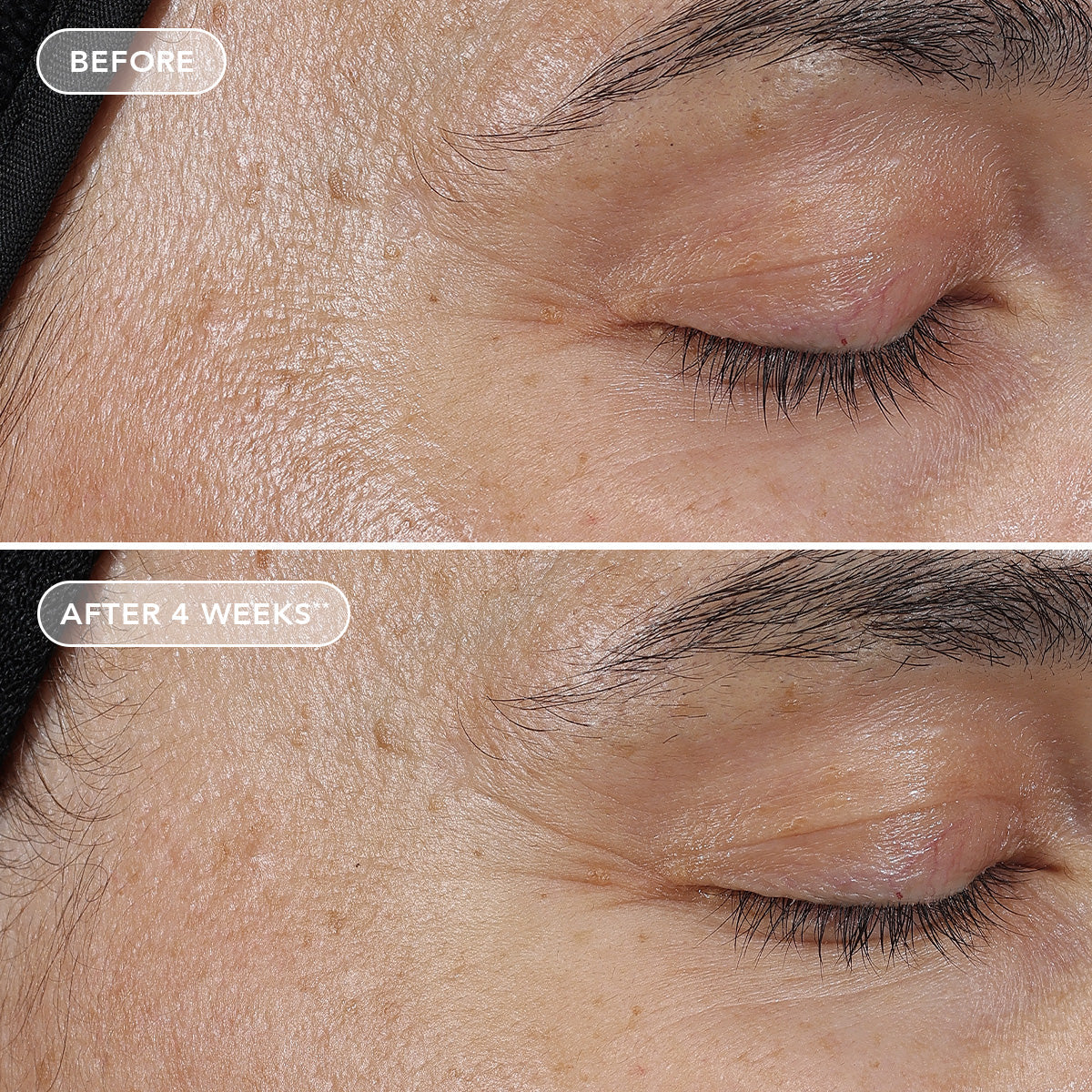 IMAGE AGELESS+ retinol pure liquid retinol 0.3%
