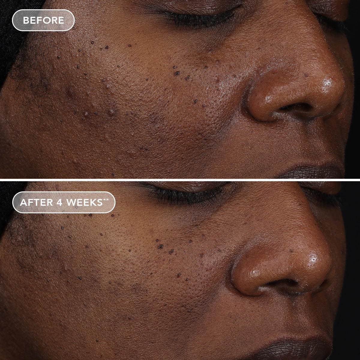 IMAGE AGELESS+ retinol repair crème 0.3% retinol complex