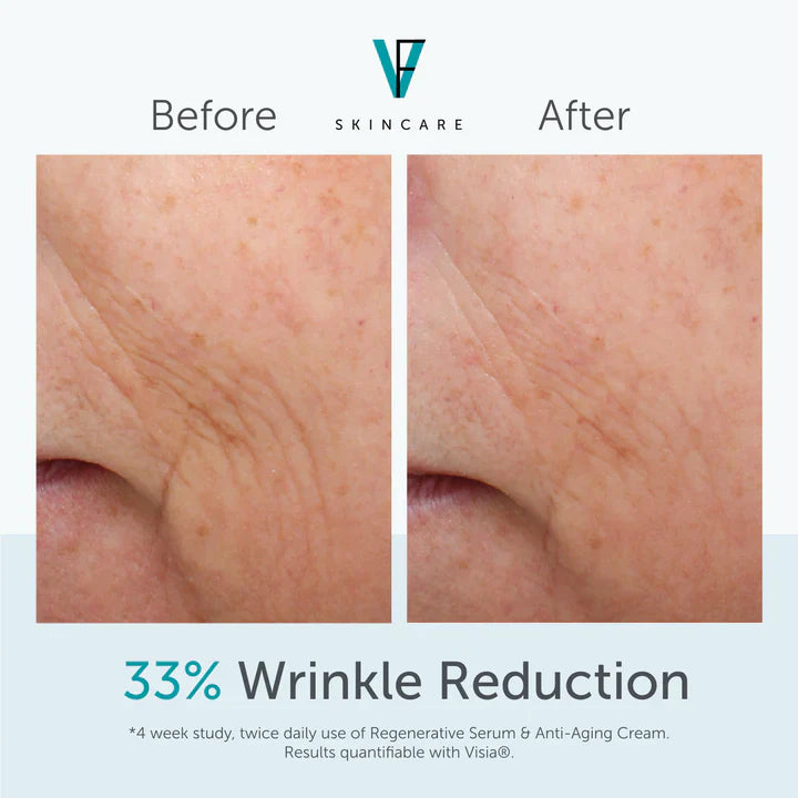 FactorFive Anti-Aging Cream