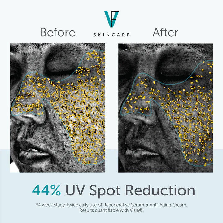 FactorFive Anti-Aging Cream
