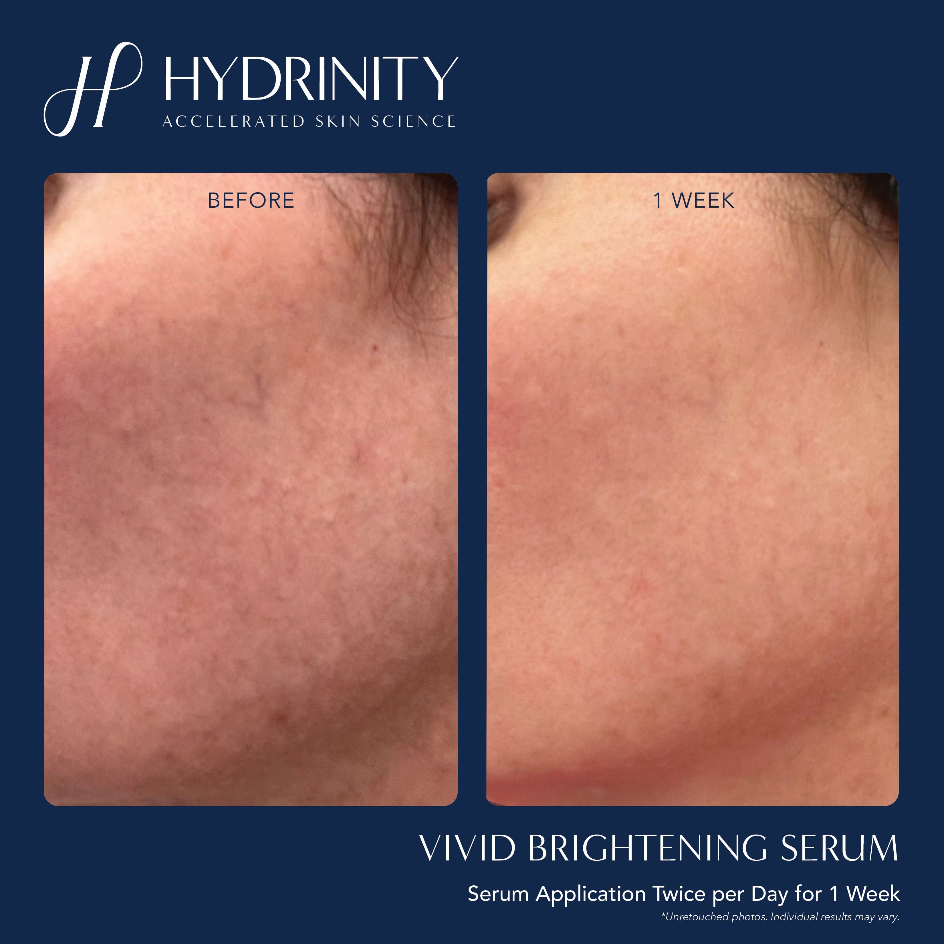 Hydrinity VIVID Brightening Serum