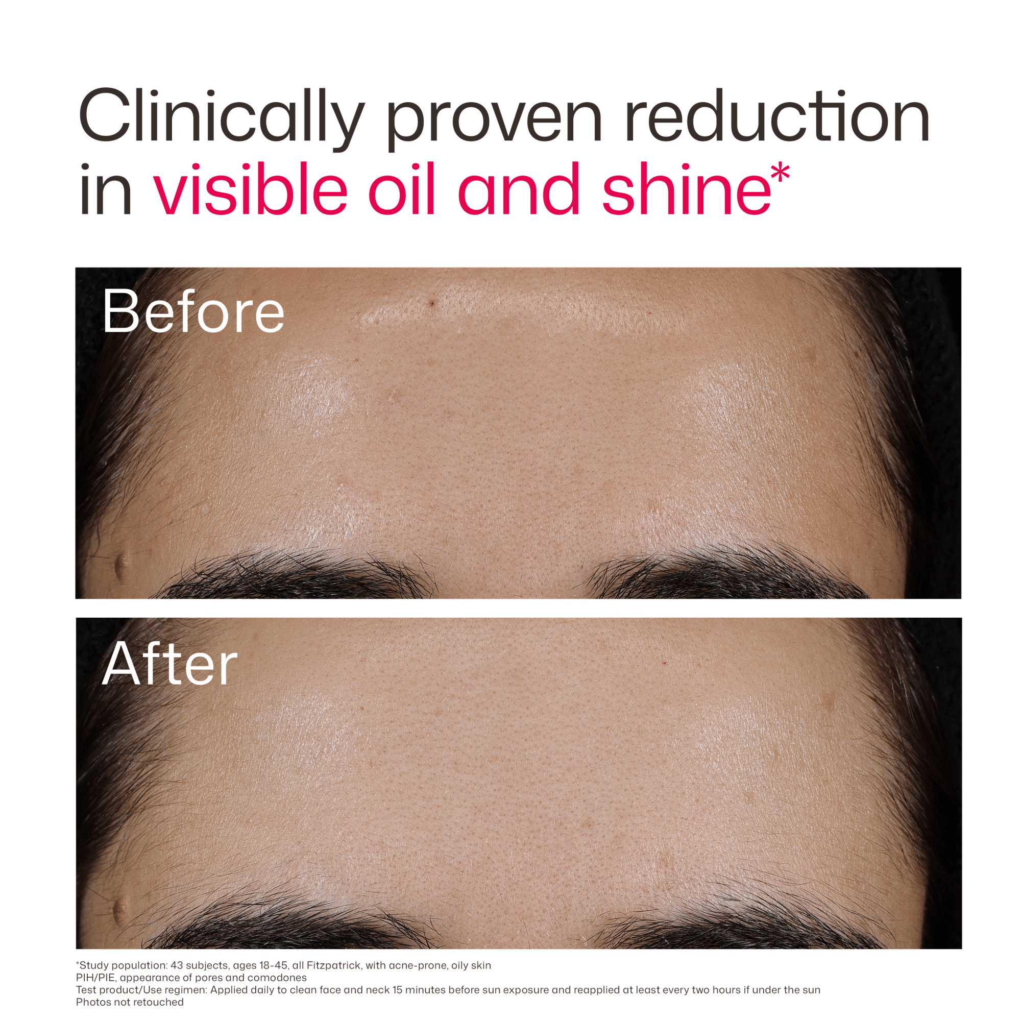 EltaMD UV Clear Acne Blemish-Prone & Oil Balancing SPF 50