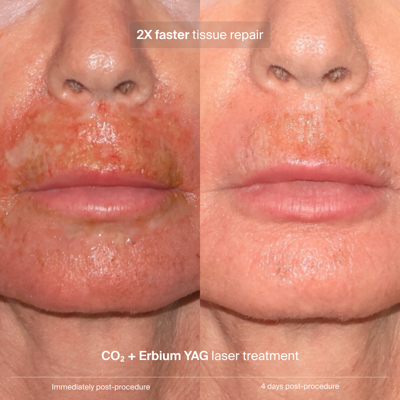 Pavise Extracellular Matrix Restore