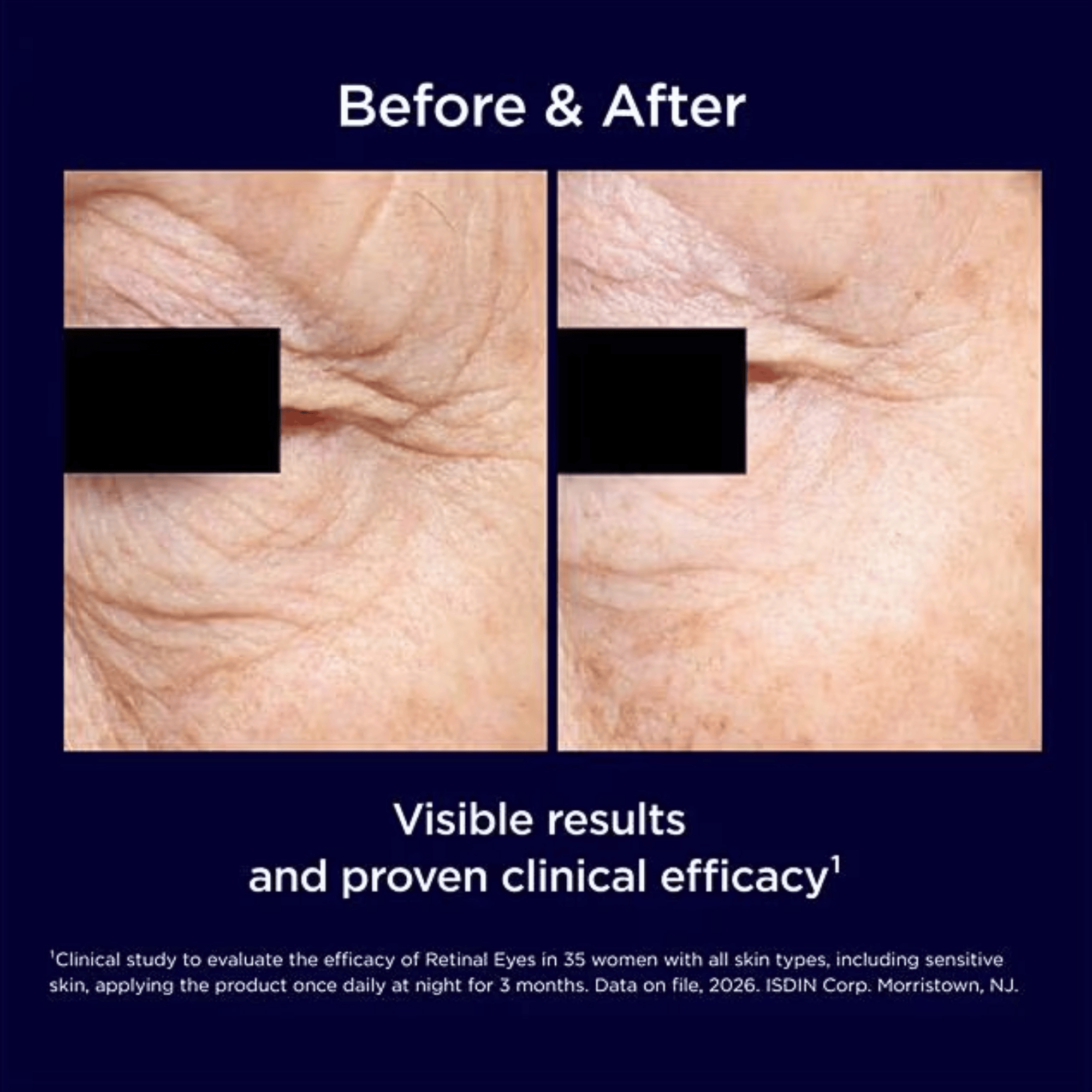 ISDIN Isdinceutics Retinal Eyes Eye Serum
