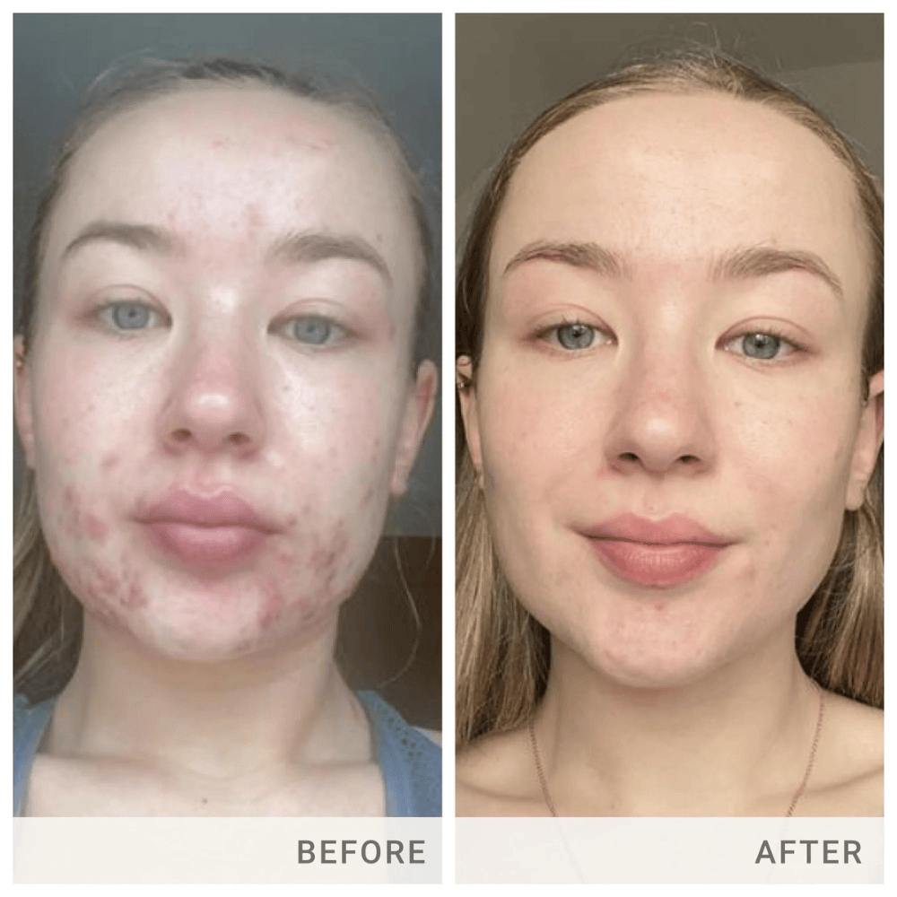 Jane Iredale Skin Accumax® 14 Week Reset Box
