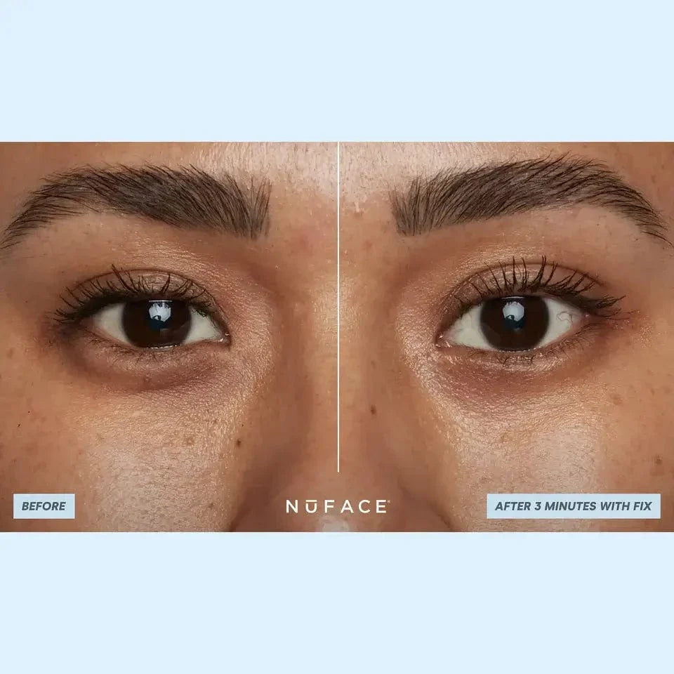 NuFACE IonPlex Hydra-Gel Power Patches