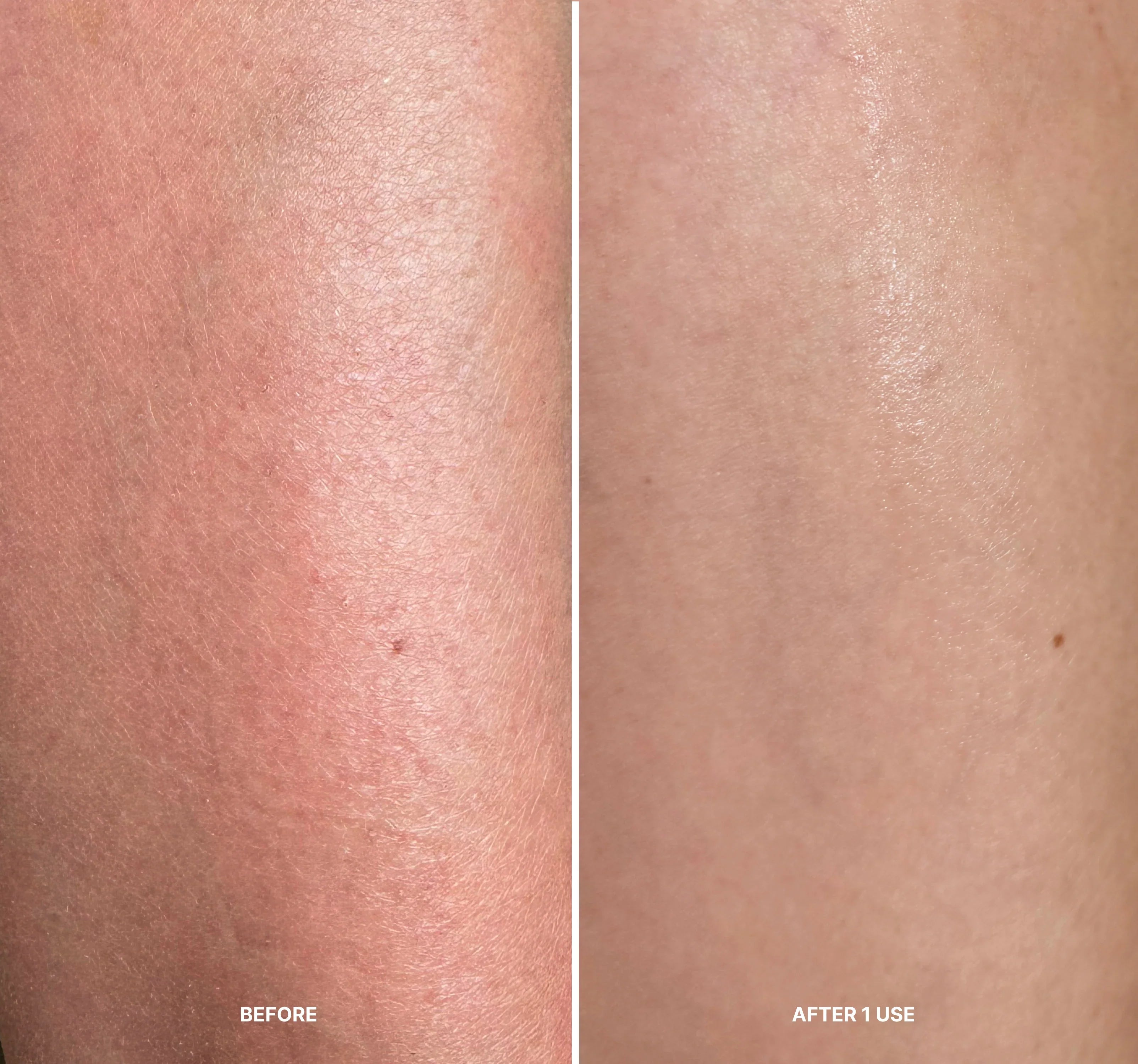 LILIS Instant Peel