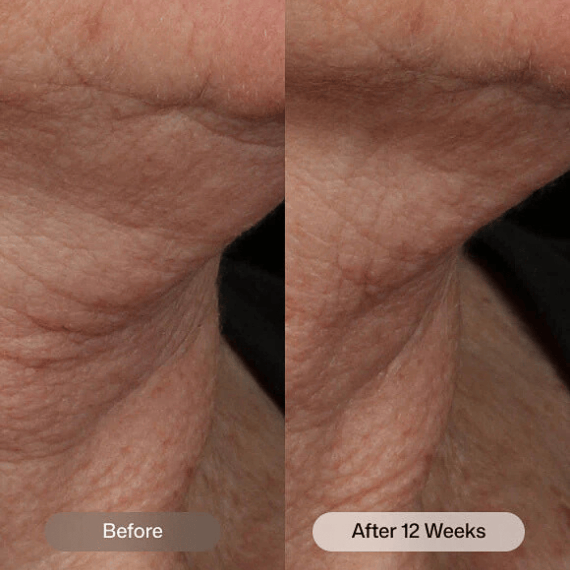 Revision Skincare Nectifirm Advanced
