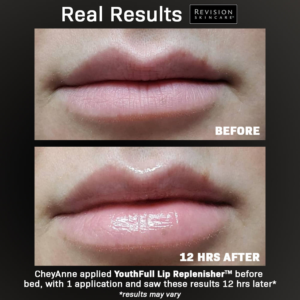 Revision® YouthFull Lip Replenisher® 0.33 oz