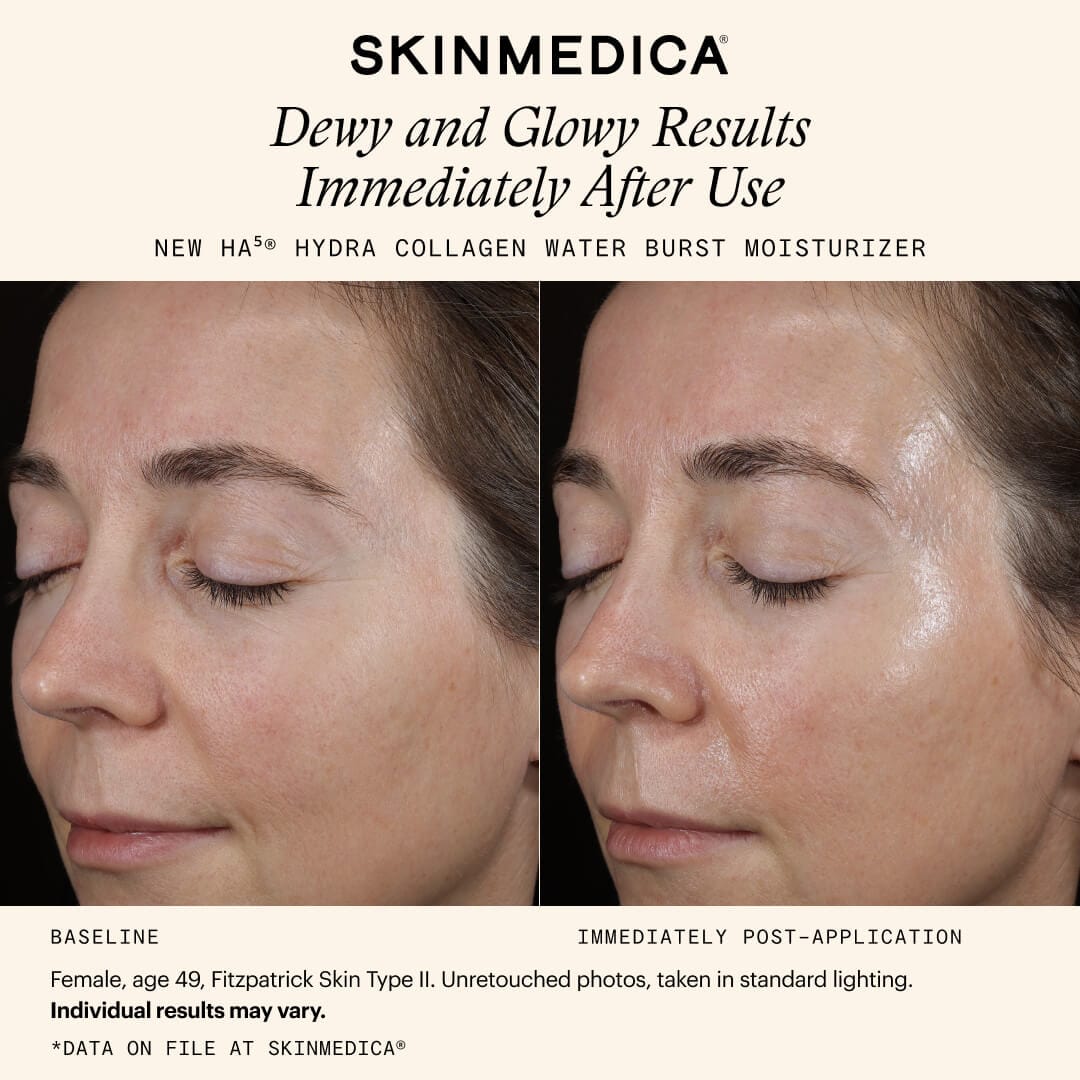 SkinMedica HA5 Hydra Collagen Water Burst Moisturizer with Vegan Collagen