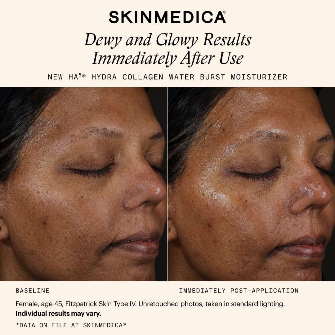 SkinMedica HA5 Hydra Collagen Water Burst Moisturizer with Vegan Collagen