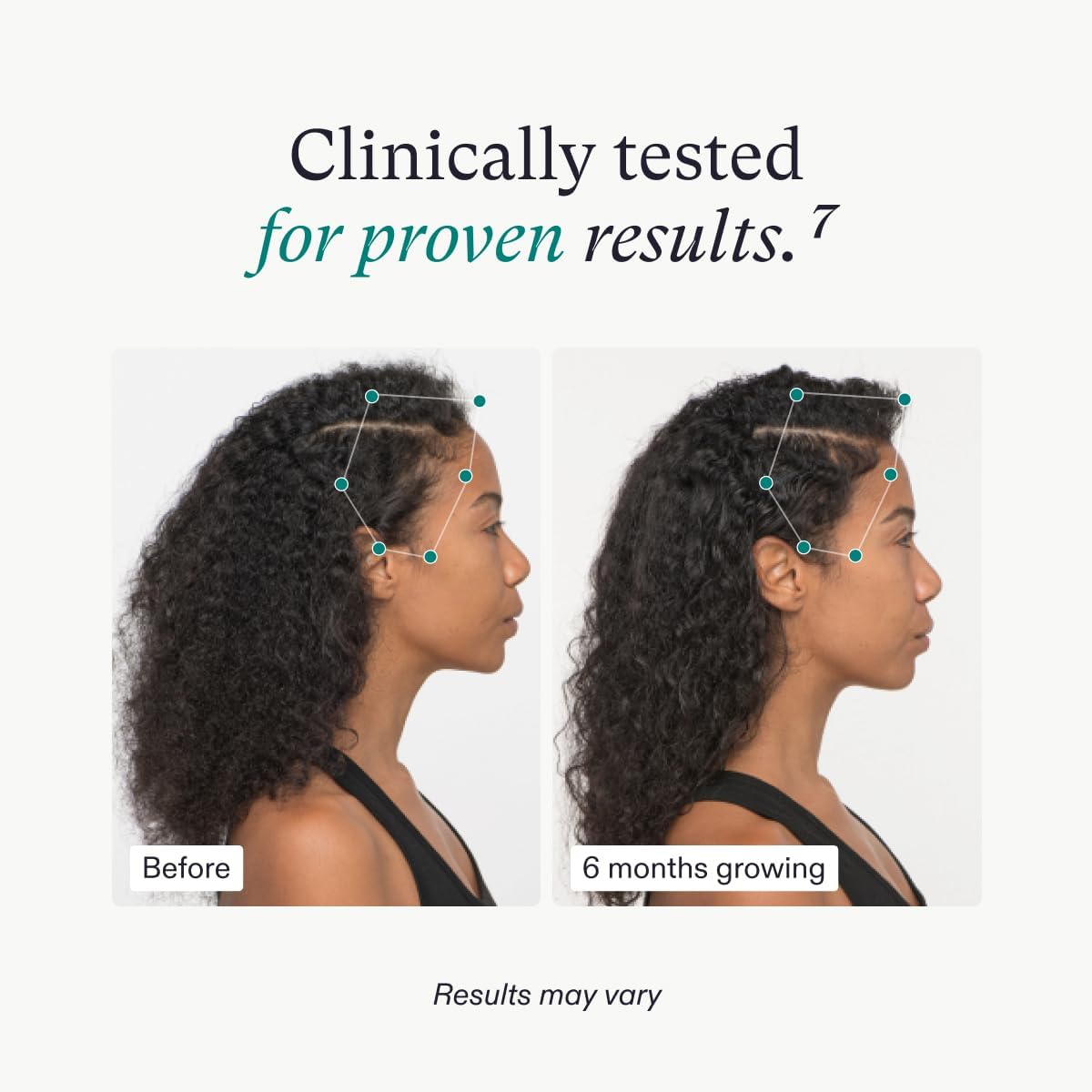 Nutrafol Women's Vegan Hair Growth Nutraceutical