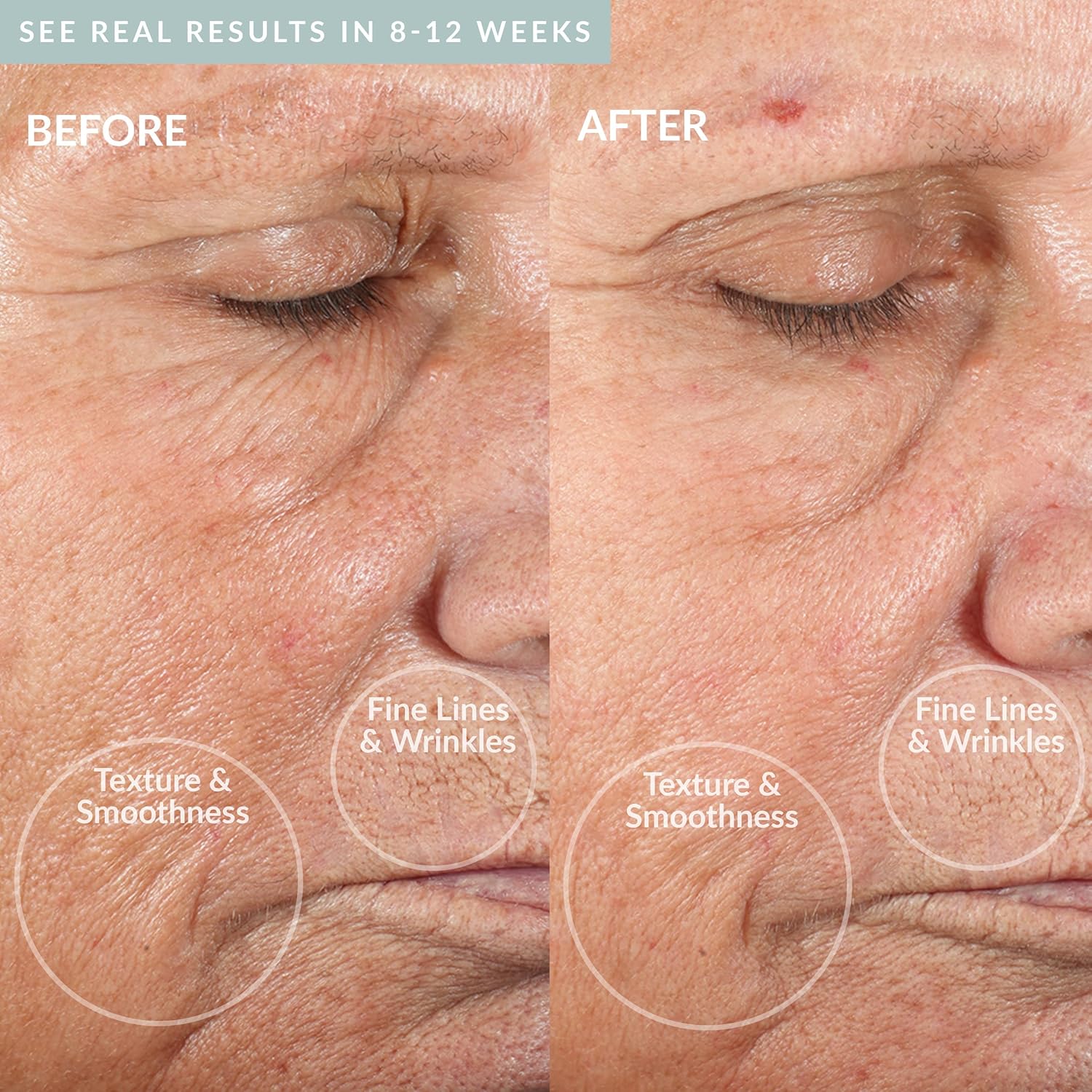 PMD Personal Microderm Classic