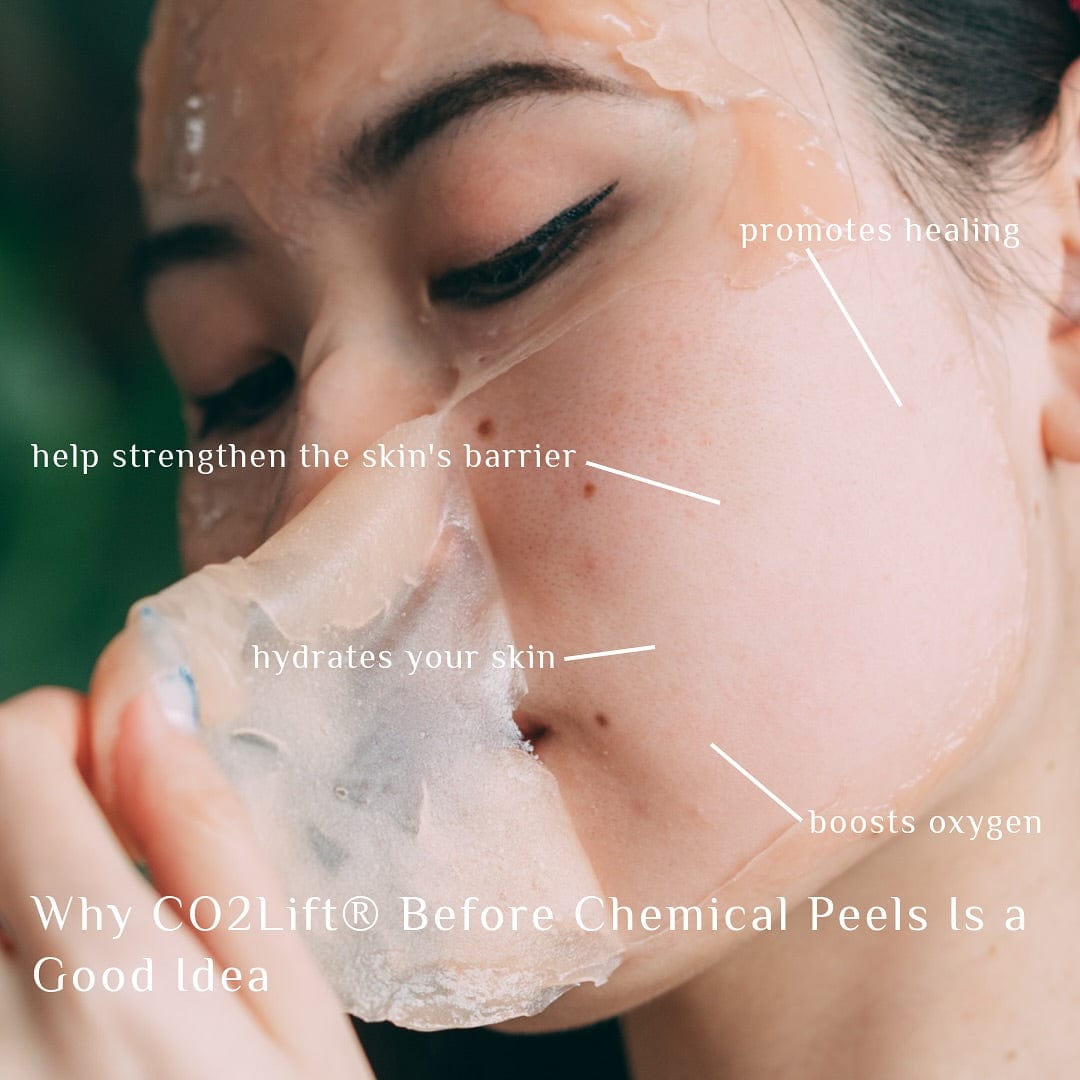CO2Lift PRO Carboxy Gel Treatment
