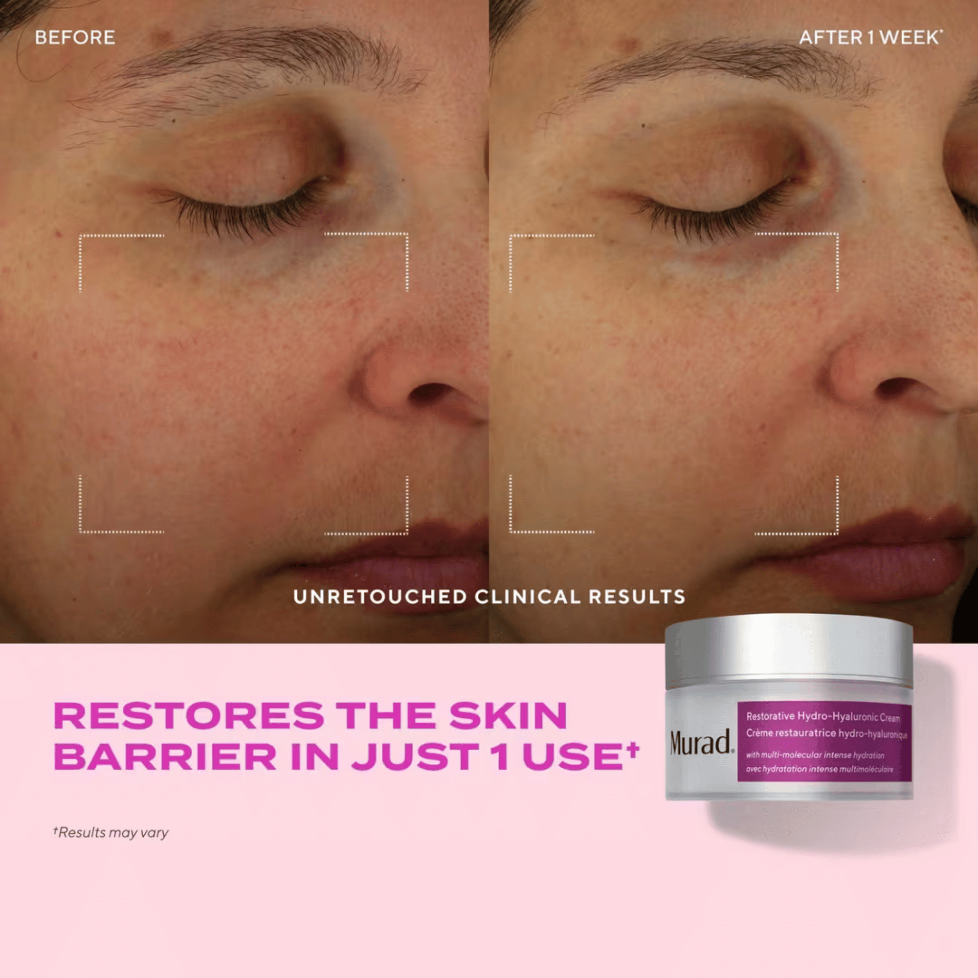 Murad Restorative Hydro-Hyaluronic Moisture Cream