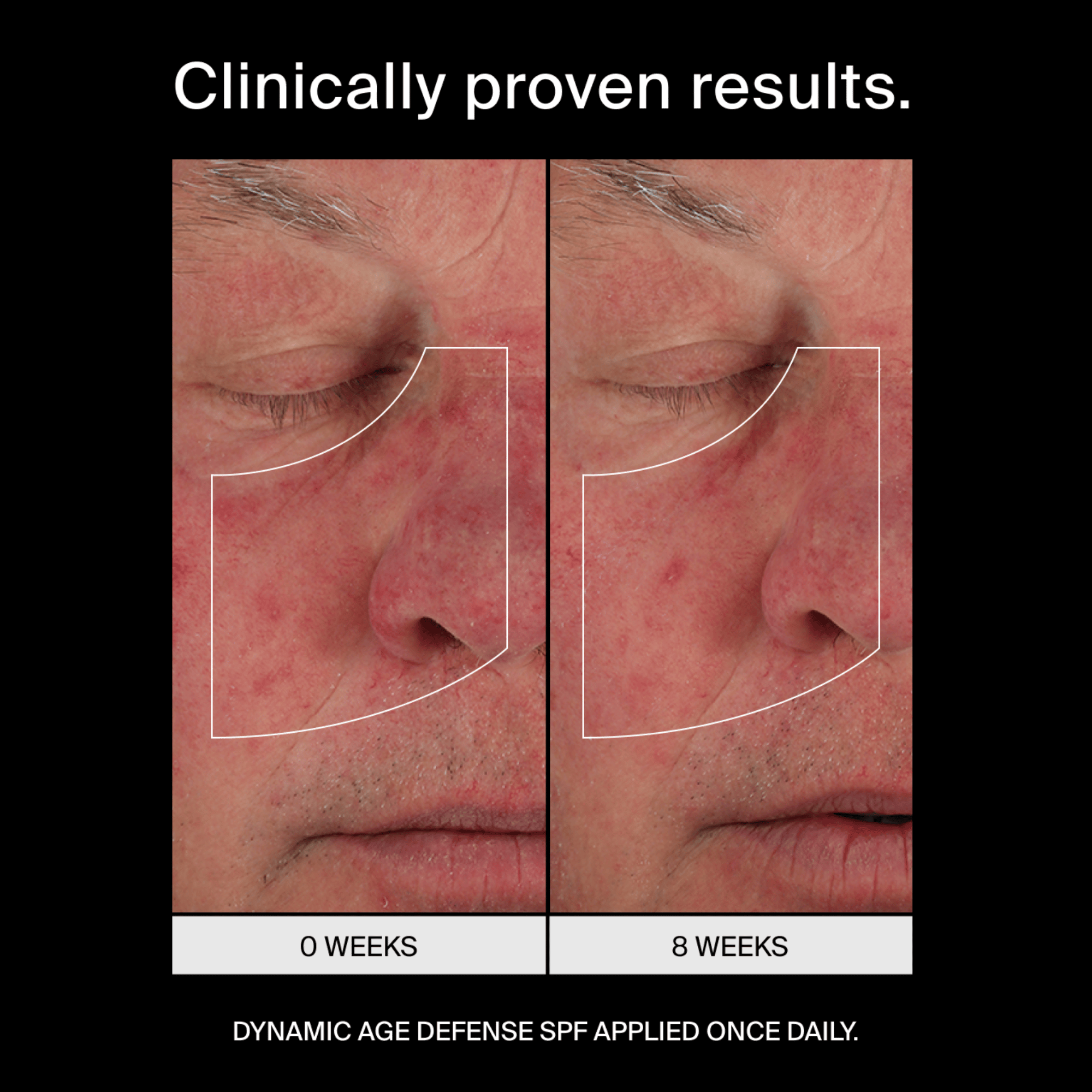 Pavise Dynamic Age Defense SPF 30 Refill Capsule
