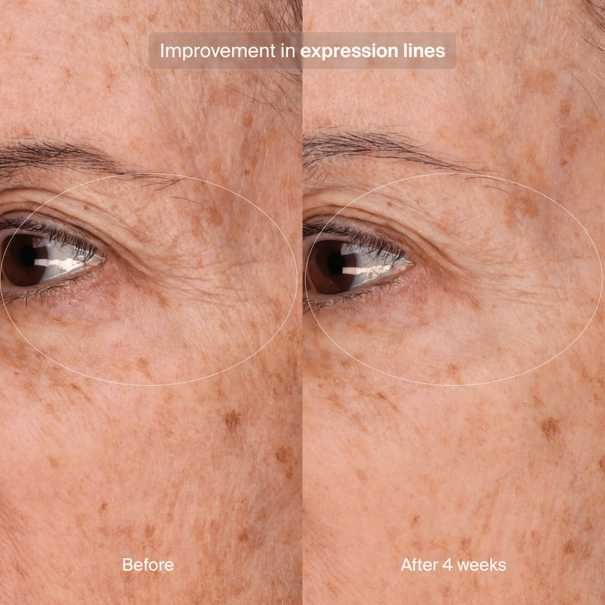 Pavise Precision Eye Lift
