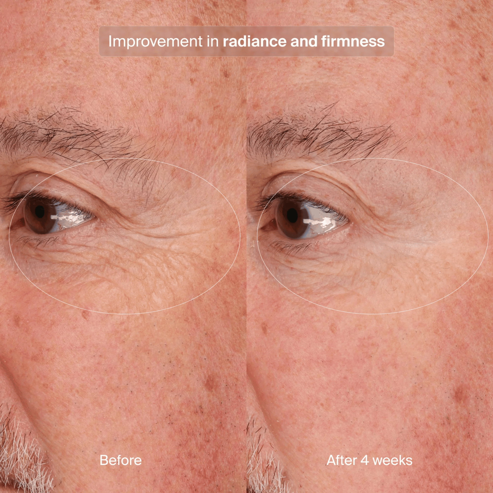 Pavise Precision Eye Lift