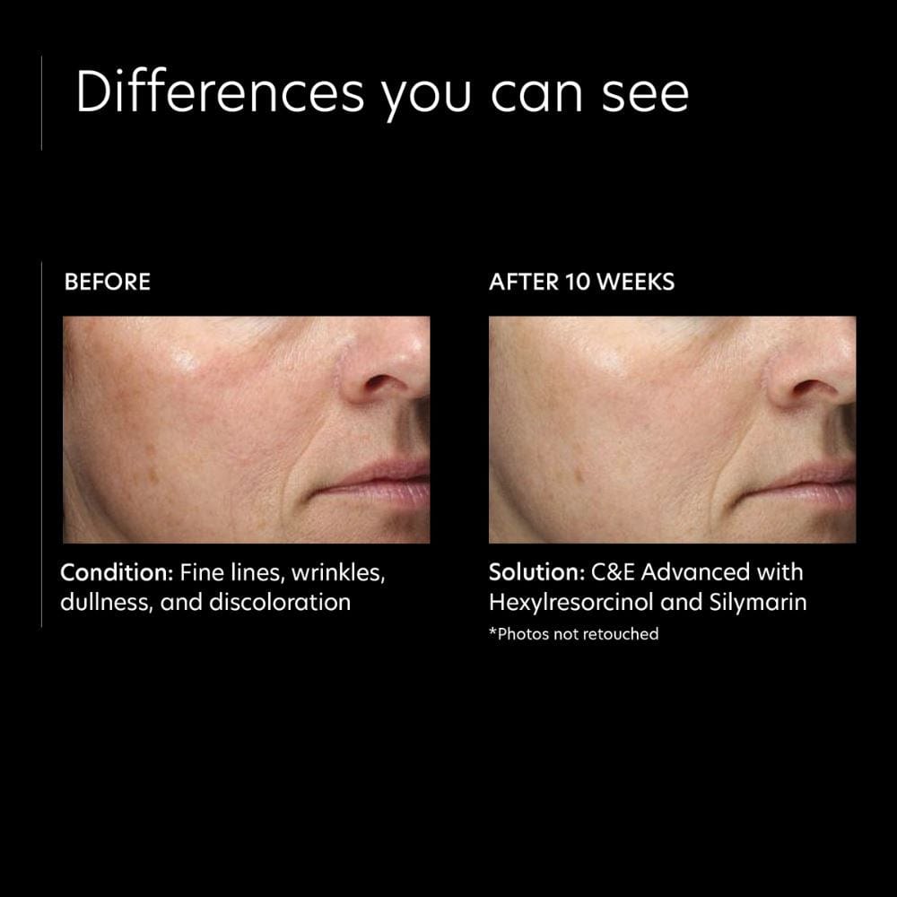 PCA Skin C&E Advanced