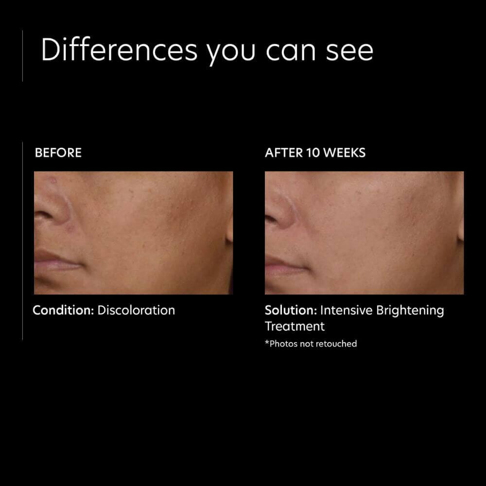 PCA Skin Intensive Brightening Treatment: 0.5% Pure Retinol Night