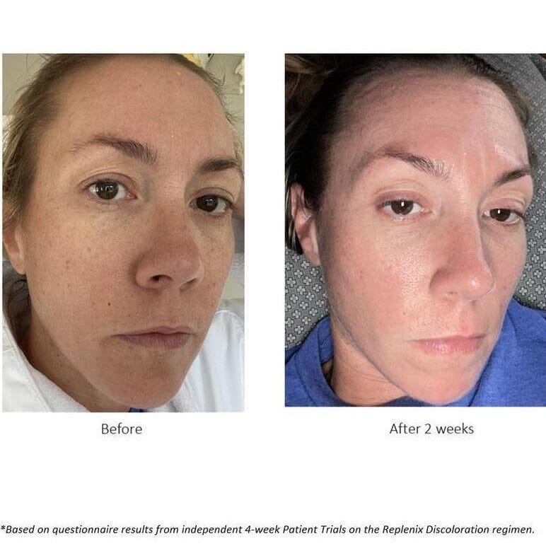 Replenix Glycolic Acid 10% Resurfacing Peel Pads