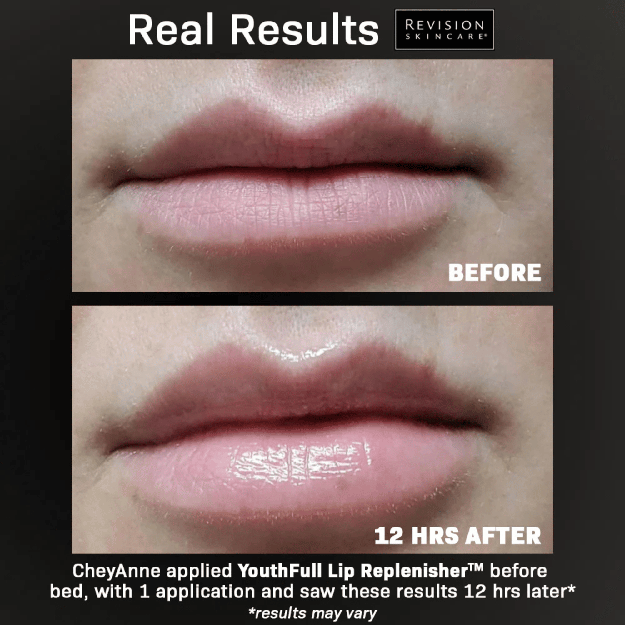 Revision Skincare YouthFull Lip Replenisher