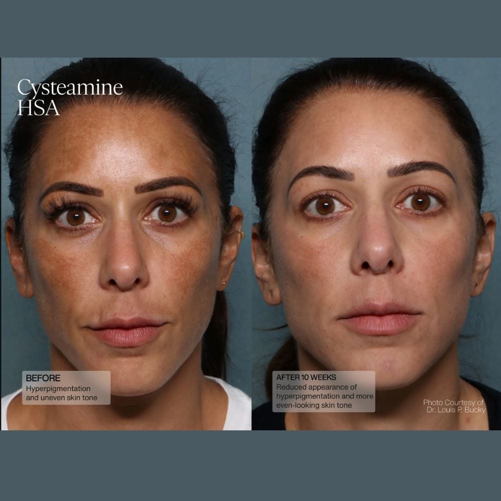 Senté Pigment & Tone Correcting Mask