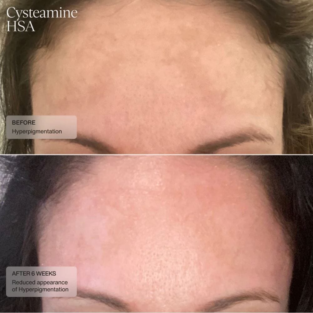 Senté Pigment & Tone Correcting Mask
