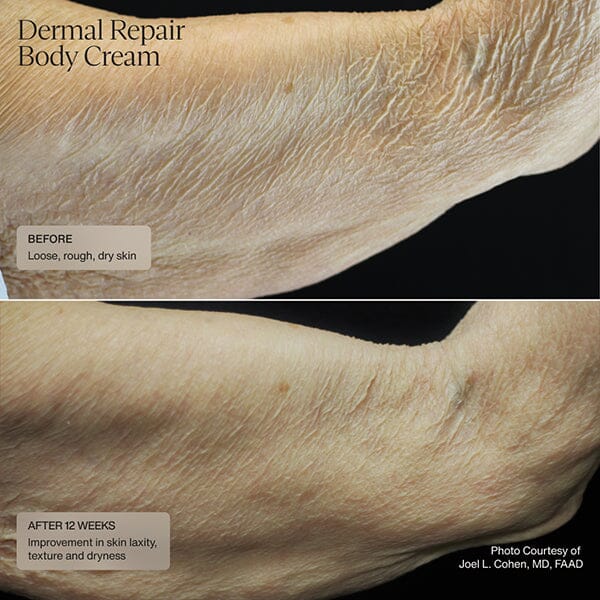 Senté Dermal Repair Body Cream