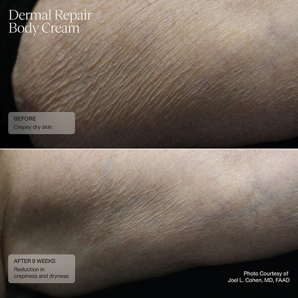 Senté Dermal Repair Body Cream