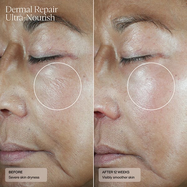Senté Dermal Repair Ultra-Nourish Creme