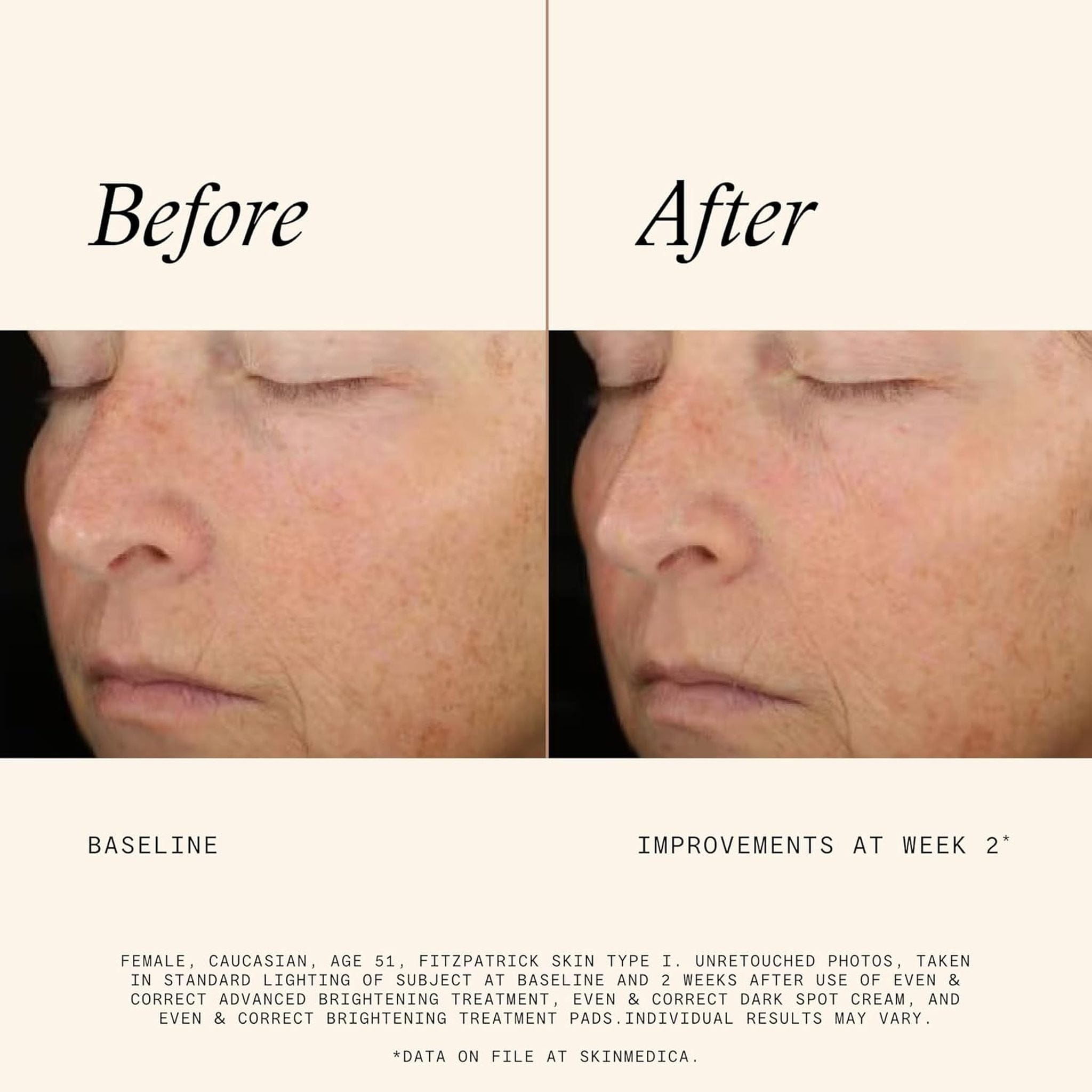 SkinMedica Even & Correct Brightening Treatment Pads