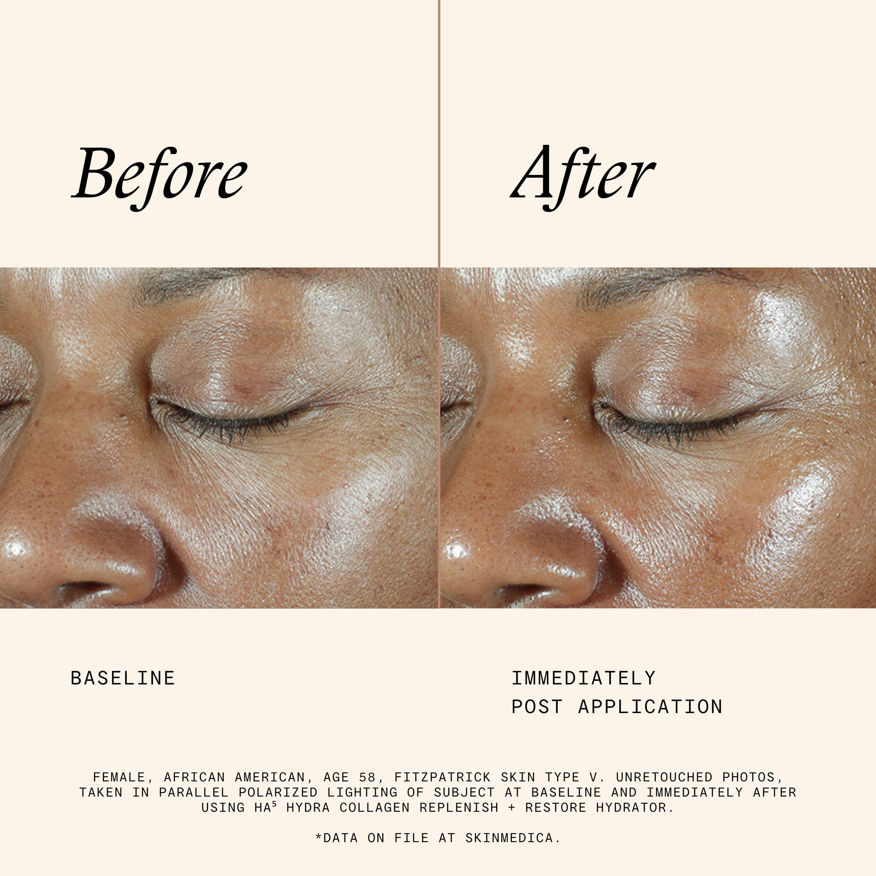 SkinMedica HA5 Hydra Collagen Hydrator with Vegan Collagen