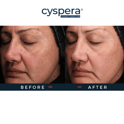 Cyspera Original+ Pigment Corrector