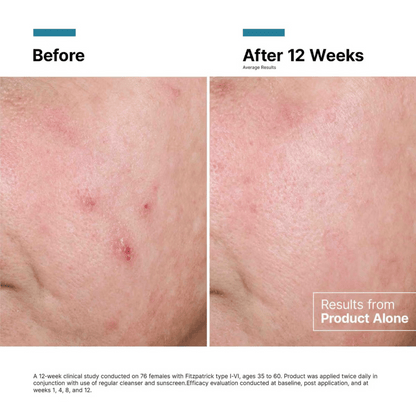 SkinCeuticals Advanced RGN-6