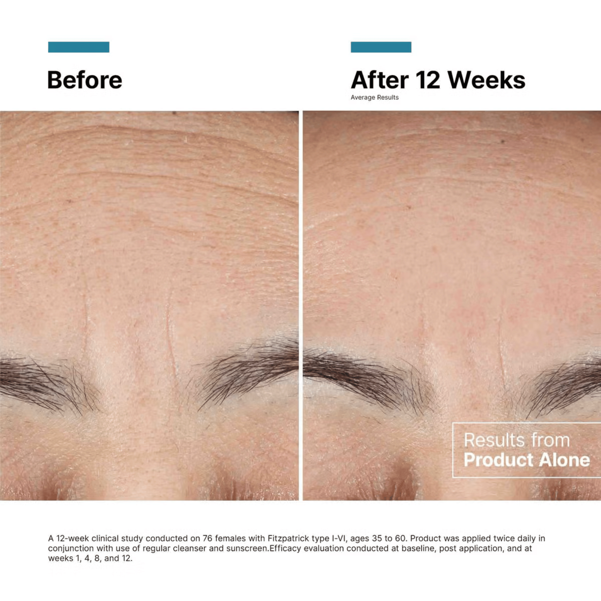 SkinCeuticals Advanced RGN-6