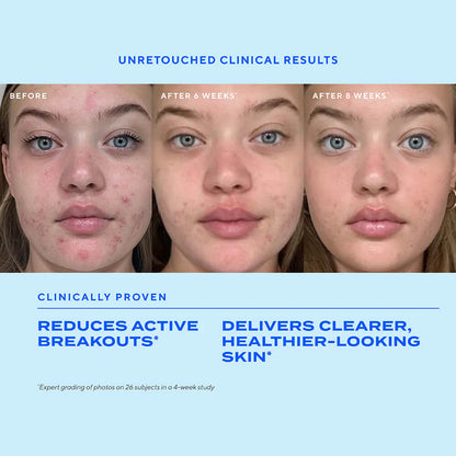 Murad Biome-Balancing Clear & Prevent Acne Treatment Serum