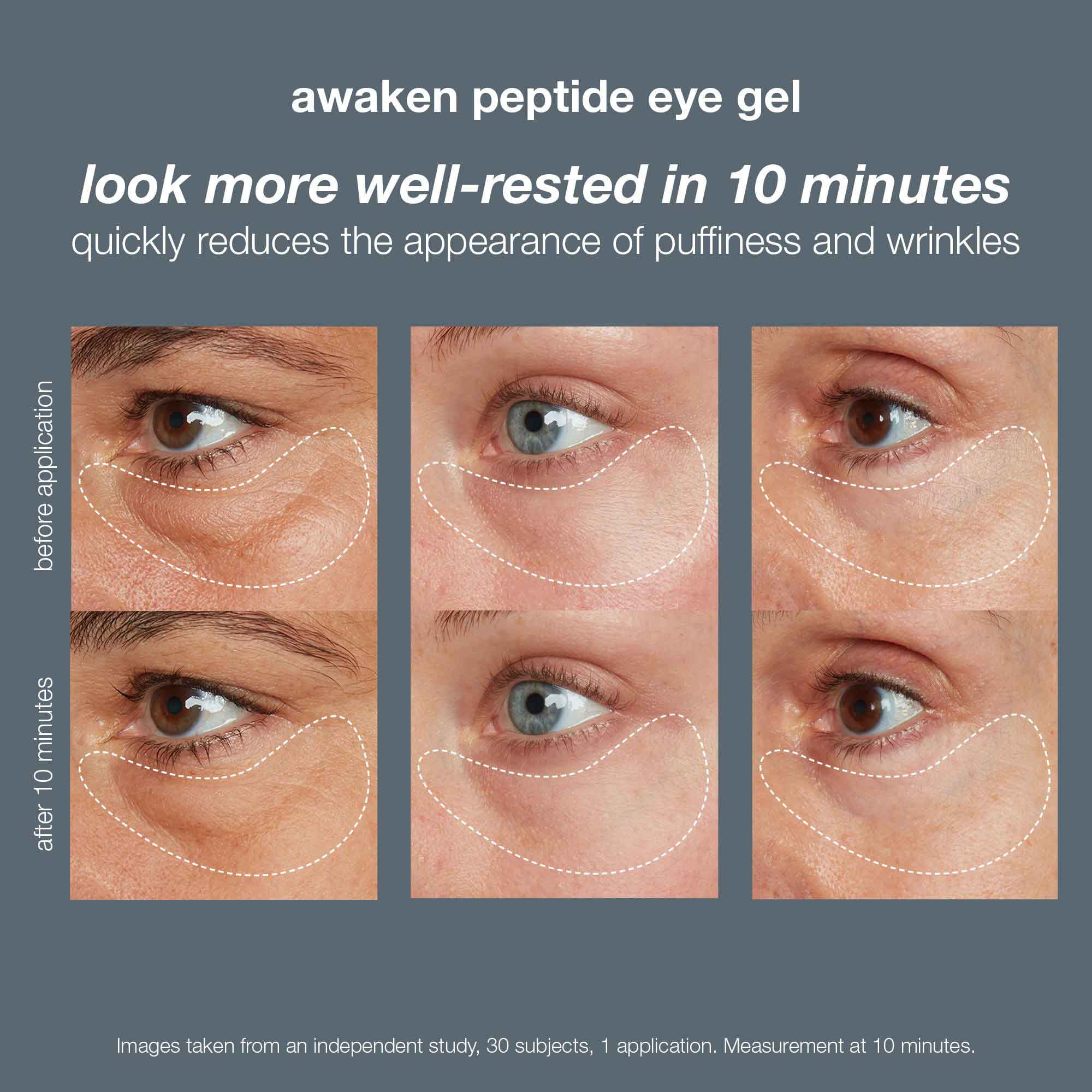 Dermalogica Awaken Peptide Depuffing Eye Gel -  0.5 oz/15 ml