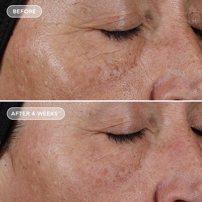 IMAGE AGELESS+ retinol pure liquid retinol 0.1%