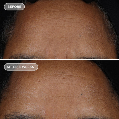 IMAGE AGELESS+ retinol pure liquid retinol 0.75% (travel size)
