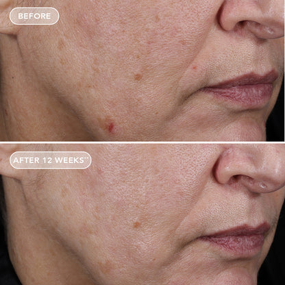 IMAGE AGELESS+ retinol pure liquid retinol 0.75%