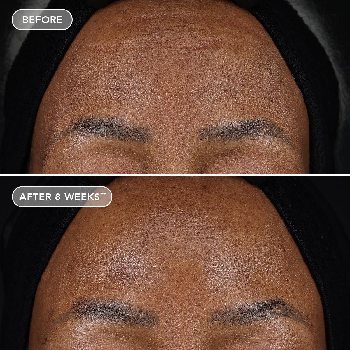 IMAGE AGELESS+ retinol treatment crème 1.2% retinol complex