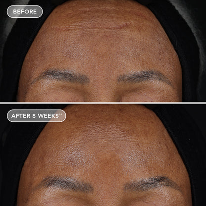 IMAGE AGELESS+ retinol treatment crème 1.2% retinol complex