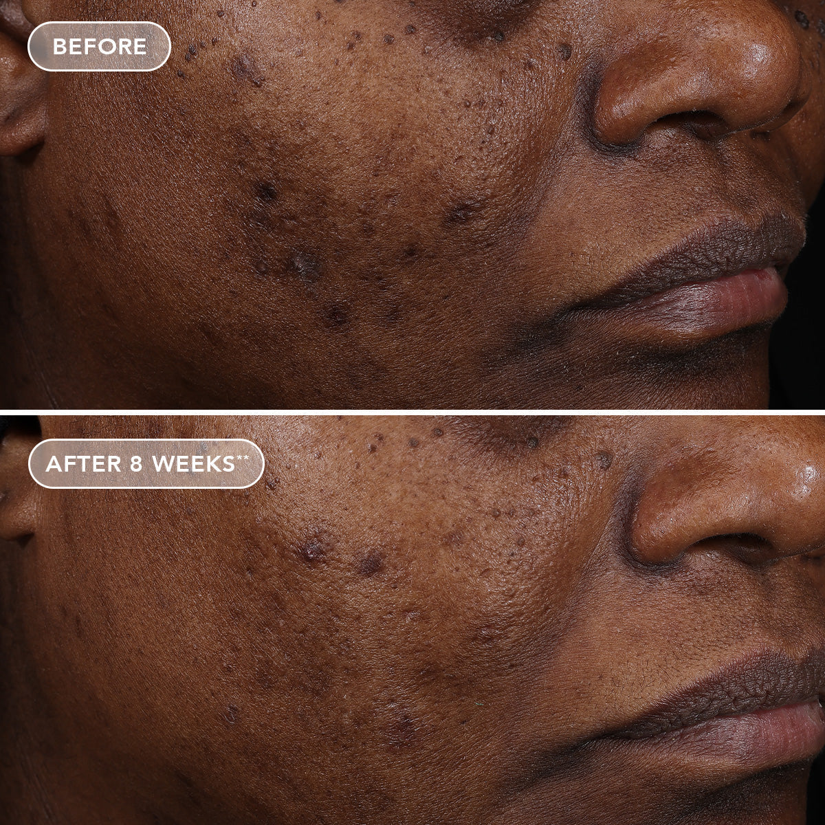 IMAGE AGELESS+ retinol treatment crème 1.2% retinol complex (travel size)
