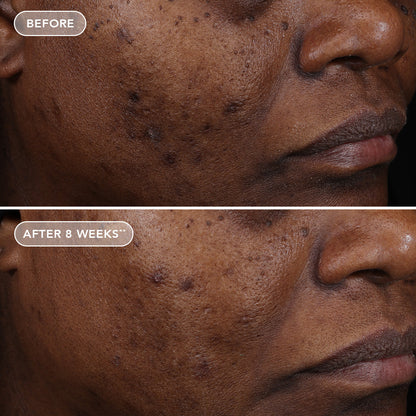 IMAGE AGELESS+ retinol treatment crème 1.2% retinol complex (travel size)