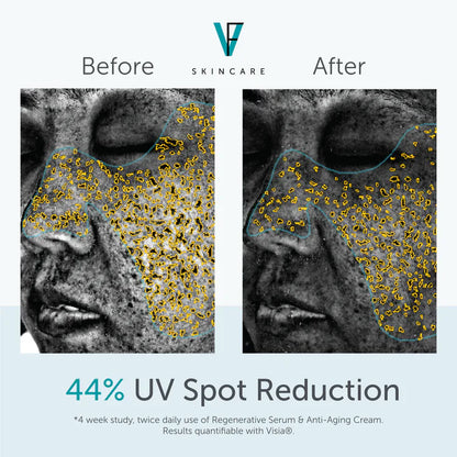 FactorFive Anti-Aging Cream