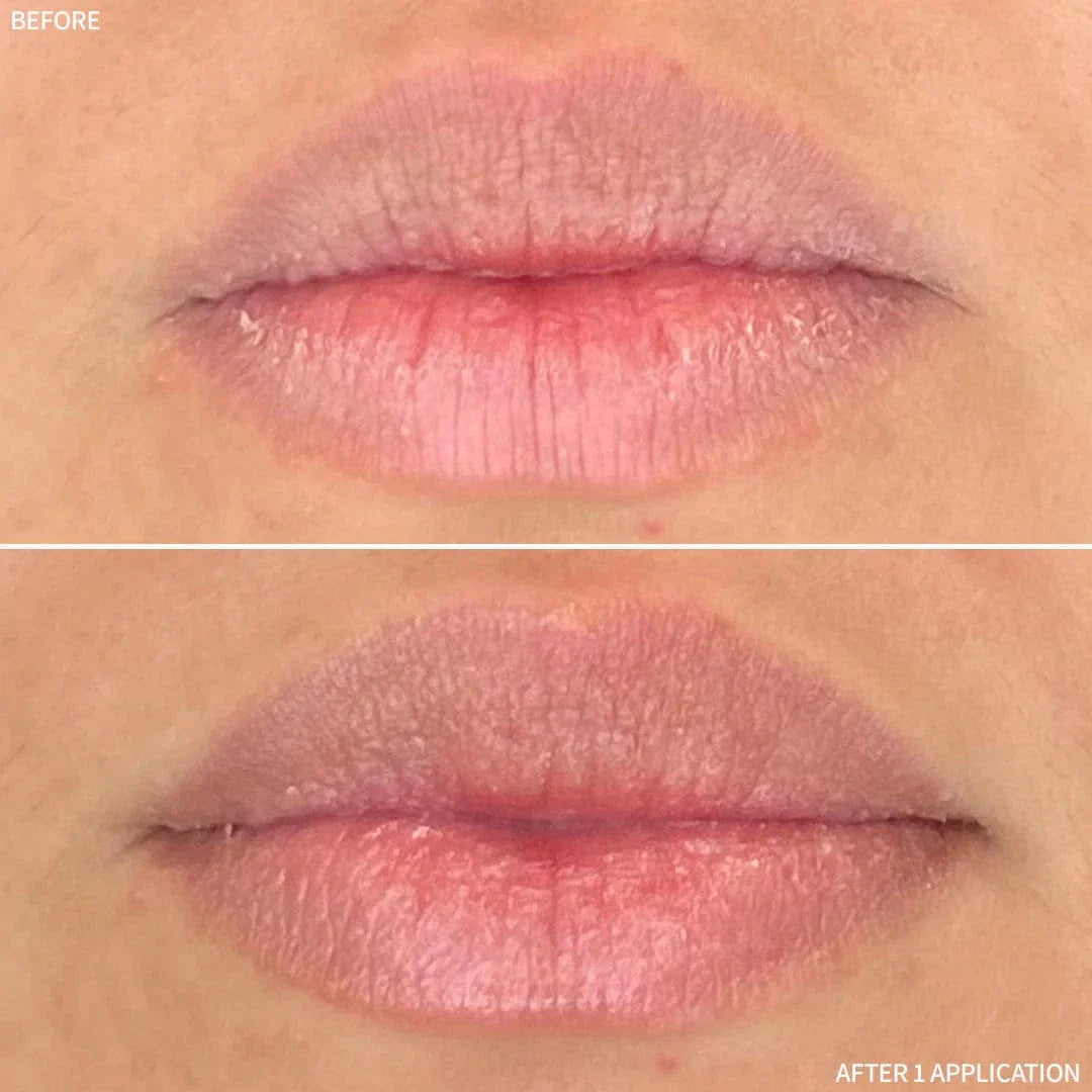 Rescue MD Restorative Lip Treatment