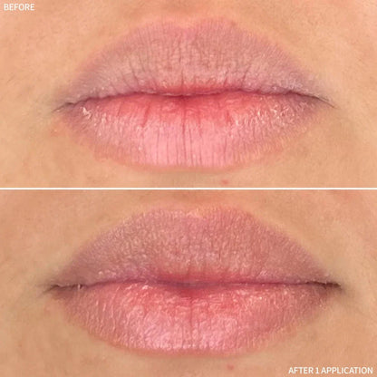 Rescue MD Restorative Lip Treatment