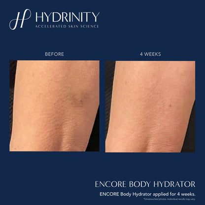 Hydrinity ENCORE Body Hydrator